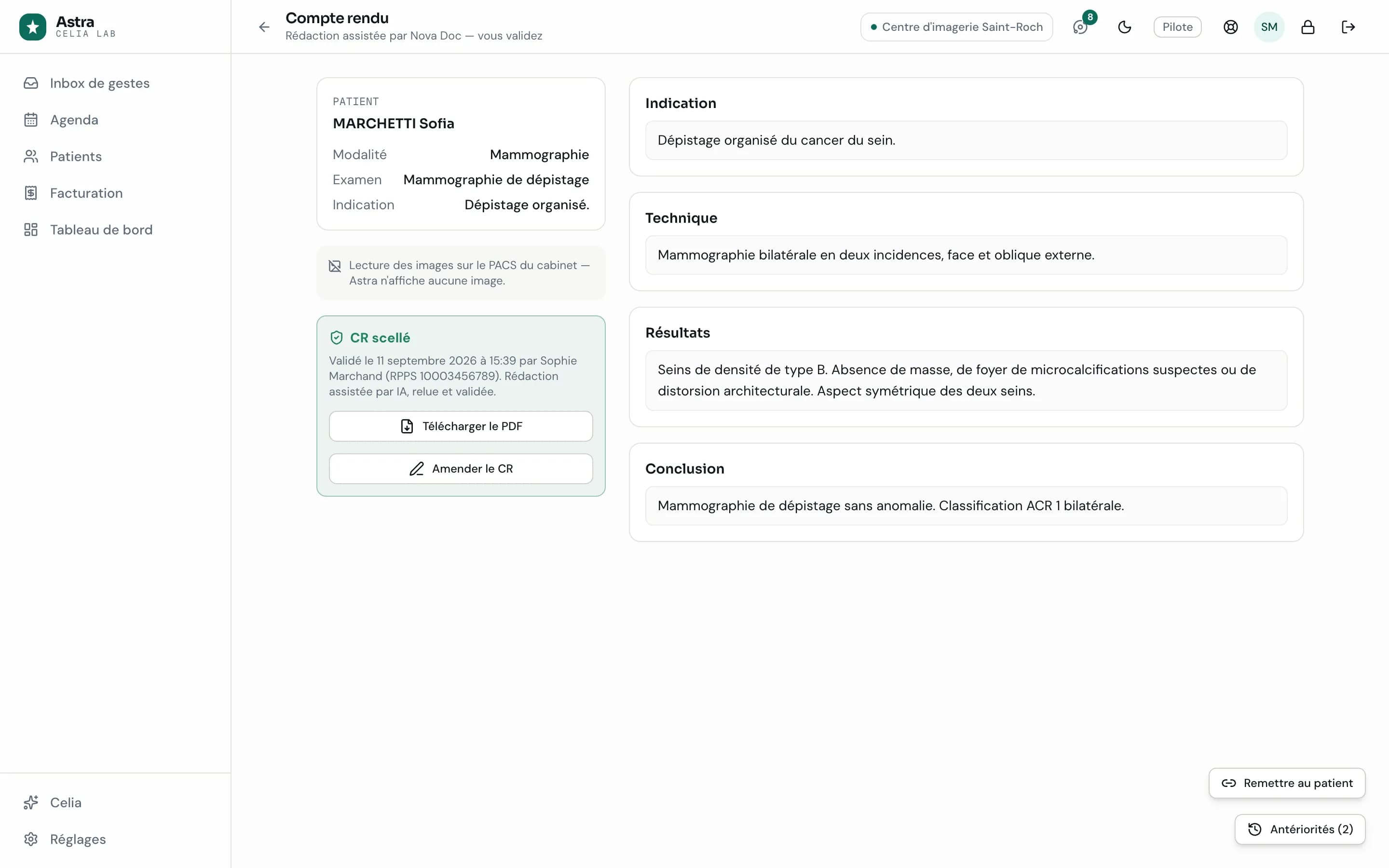 Compte rendu de mammographie de dépistage dans Astra, marqué « CR scellé » avec la date, l'heure et le RPPS du radiologue signataire ; indication, technique, résultats et conclusion.